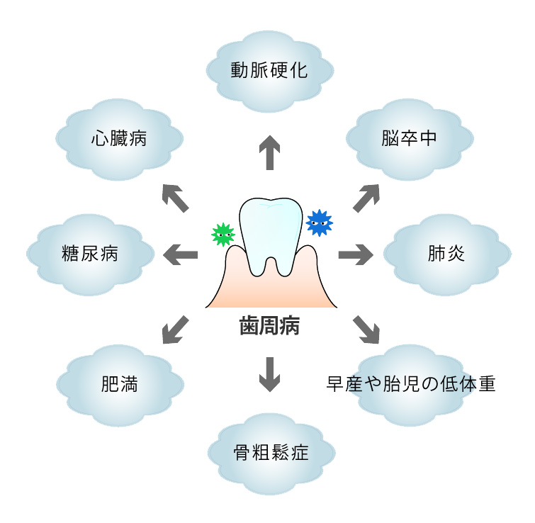 歯周病を放置していると、身体全体に影響が出ます